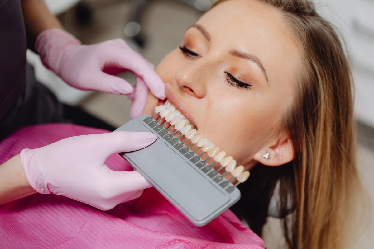 Smile Design (Veneers)