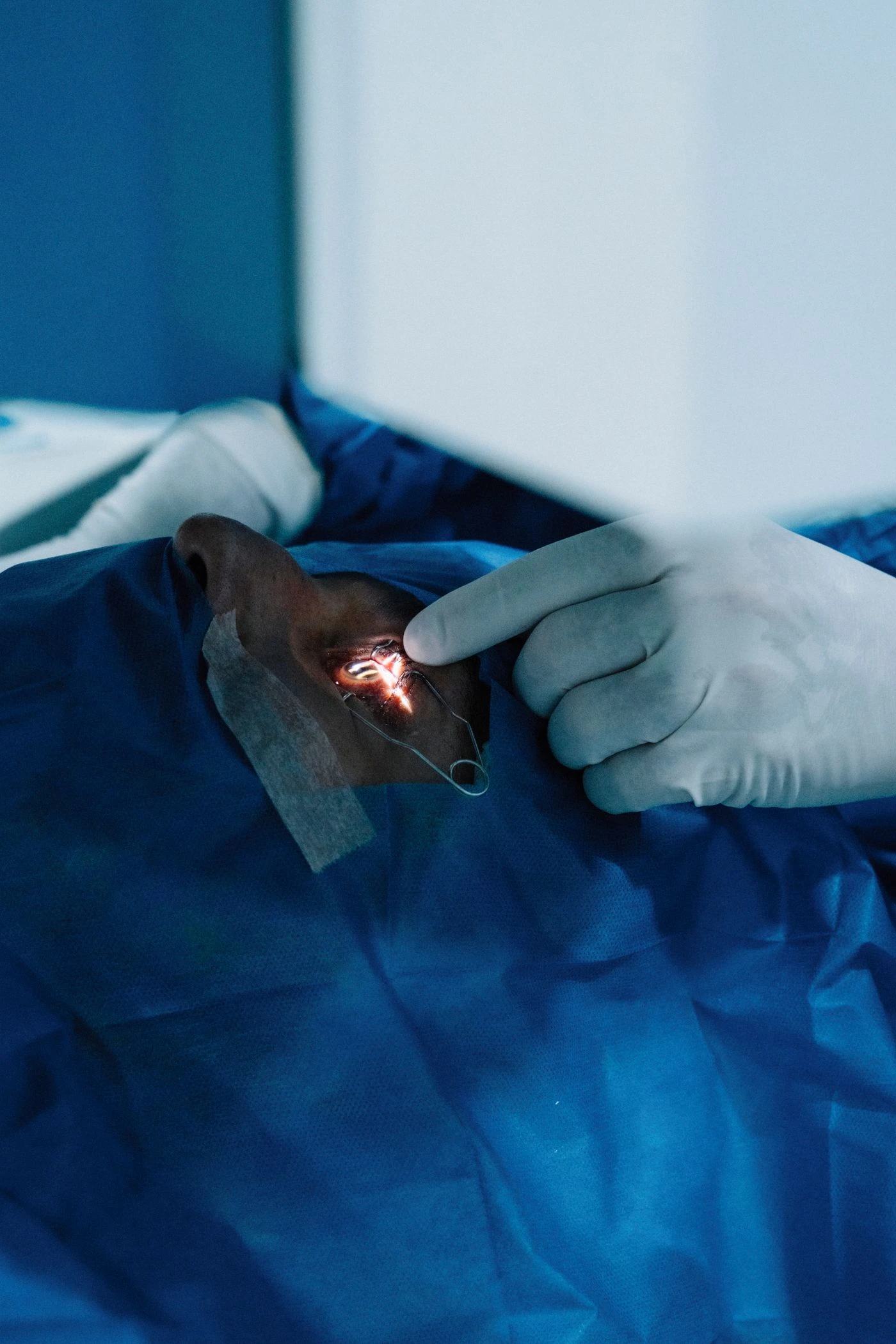 CATARACT SURGERY