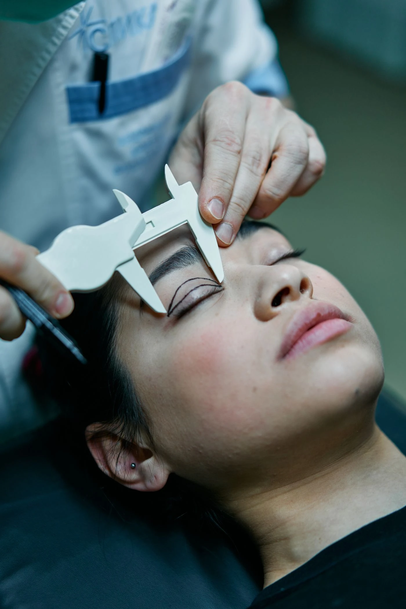 CIRUGÍA LASIK