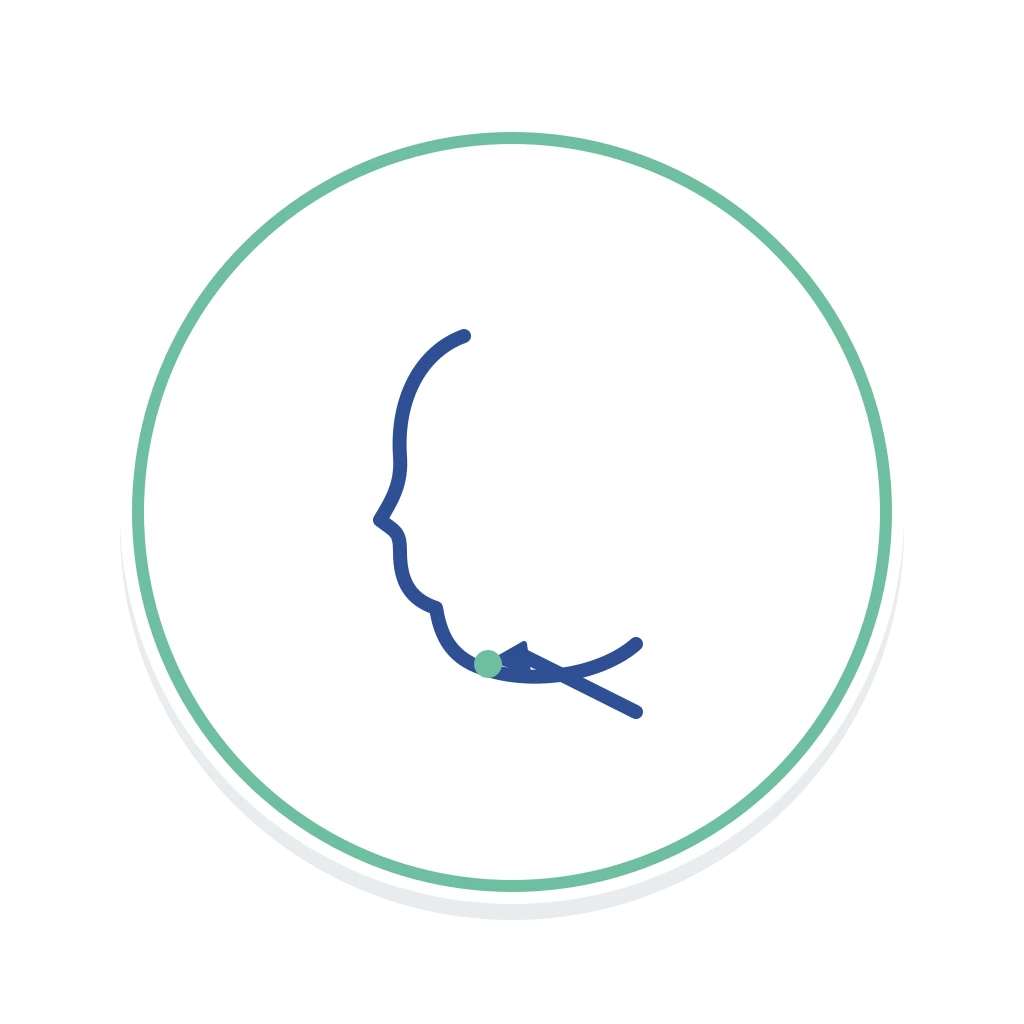 Liposucción de Cuello (Lipopapada)